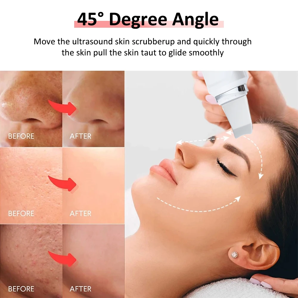 ЖК дисплей ультразвуковой скруббер для кожи Глубокая чистка лица пилинг Лопата