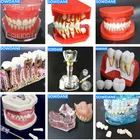 Модель зубы для обучения стоматологии, стандартная модель зубы, модель зубы для взрослых и детей, модель зубного врача