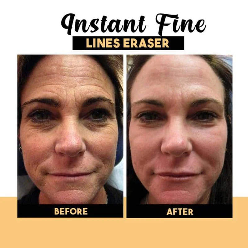 

N Face Line Cream Solutions Eye Cream Instantly Remove Eye Bag Dark Circles Anti-aging Anti-Wrinkle Repair Puffiness Eye Essence