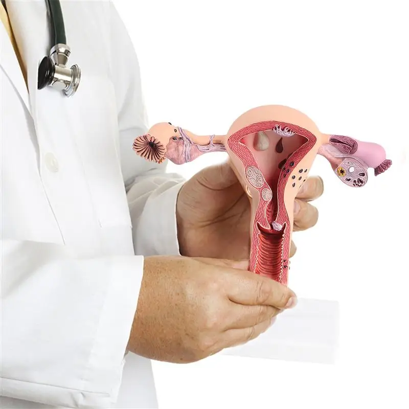 

1Pc Practical Uterus Model Female Reproductive System Model for Medical Training