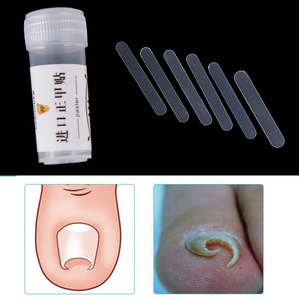 

5pcs/box Professional Ingrown Toe Nail Correction Sticker Patch Paronychia Correction File Acronyx Wire Corrector Foot Care Tool