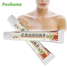 20g White Spot Ointment Vitiligo Cream Treatment Antibacterial Cream Localized Disease Mycosis Leukoplakia Plaster Skin Care