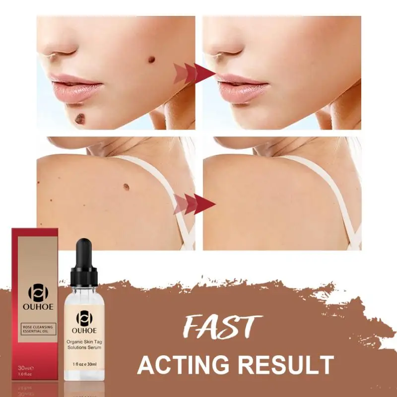 

Organic Tags Remove Serum Mole Corrector Skin Tag Remover Black Spot Purifying Serum Skin Lightening Mole TAG Removal Essences