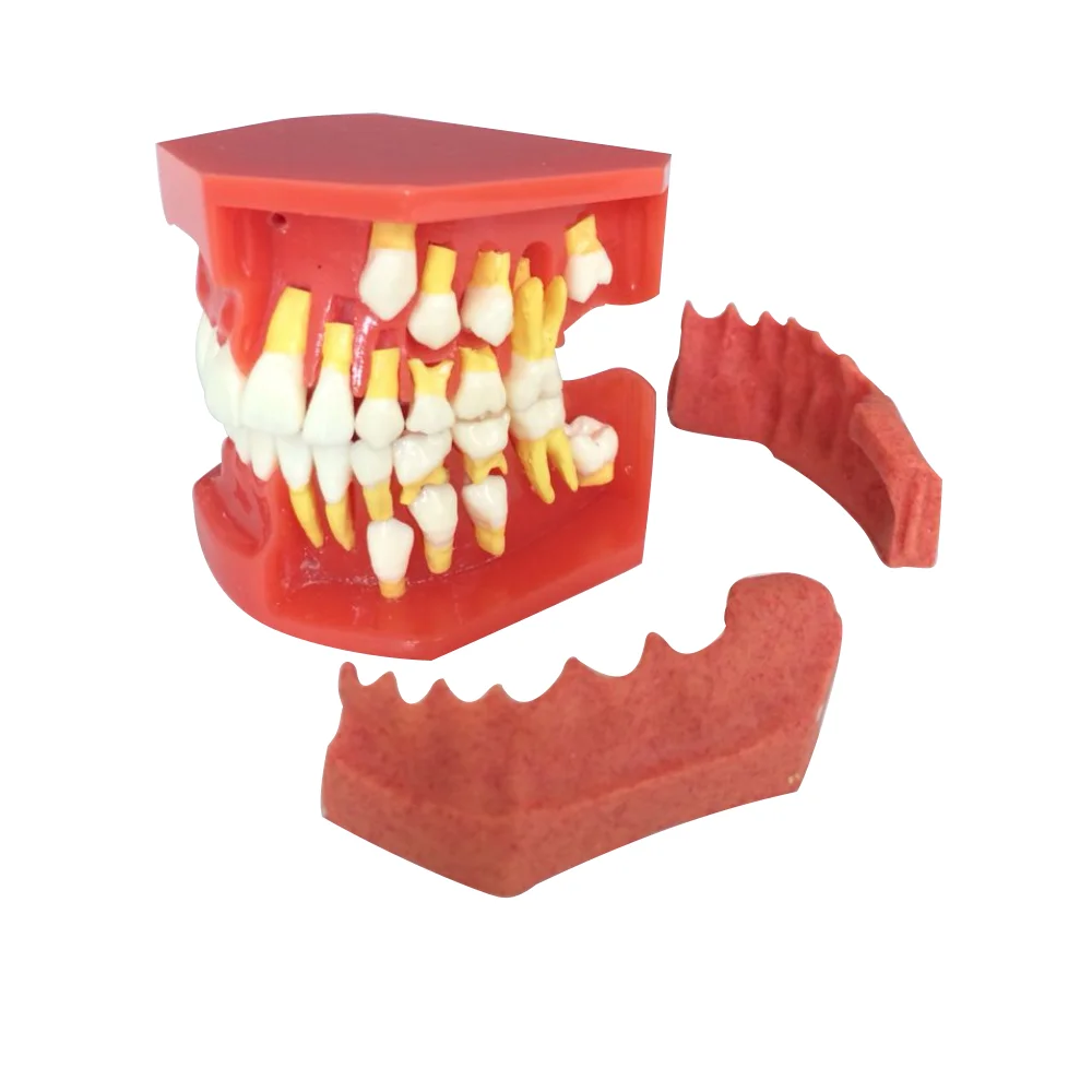 Dental tooth model  Primary Permanent Tooth Model Alternative Deciduous Teeth Model For Studying Teaching Demonstration