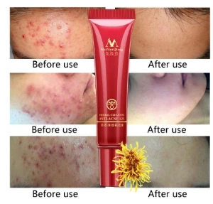 Отбеливающий крем для лица против прыщей и комедонов 15 г| |