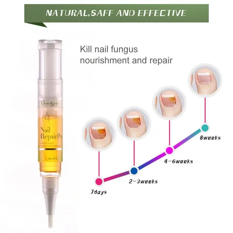 1 шт. ручка для лечения грибков ногтей против грибковой инфекции биологический
