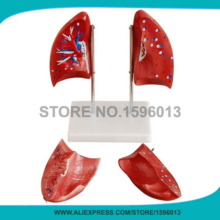 4 parts Detachable Lung model Human Lung AnatomyModel