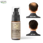 Средство для роста волос ELECOOL, быстрорастущее масло для волос, восстанавливающее выпадение волос, средство для ухода за волосами, косметическое средство для мужчин и женщин, 20 мл