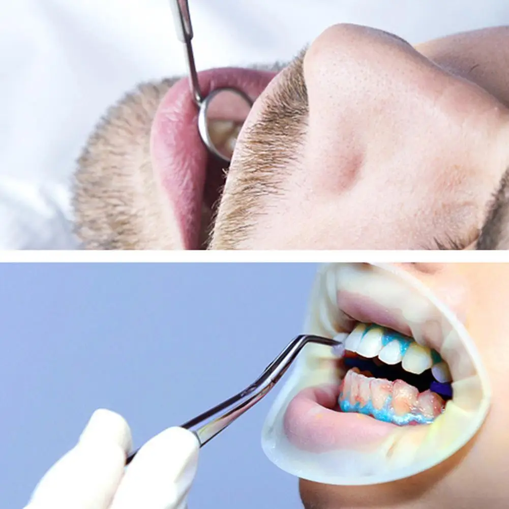 Стальные стоматологические инструменты стоматологический пинцет зеркальный