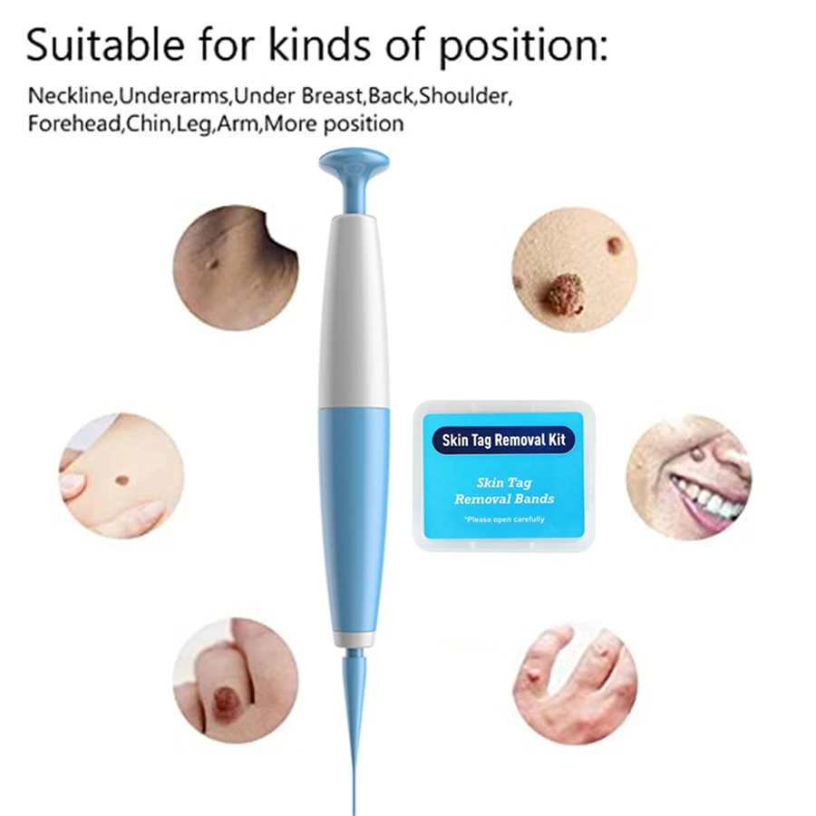 Auto Band Non Toxic Face Care Mole Wart Tool For Small To Medium Blue Skin Tag Removal Kit With Cleansing Swabs Home Use Adult |
