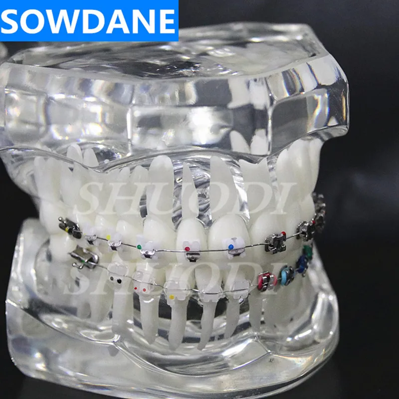 Стоматологическая Ортодонтическая модель 4 вида кронштейнов с керамическим