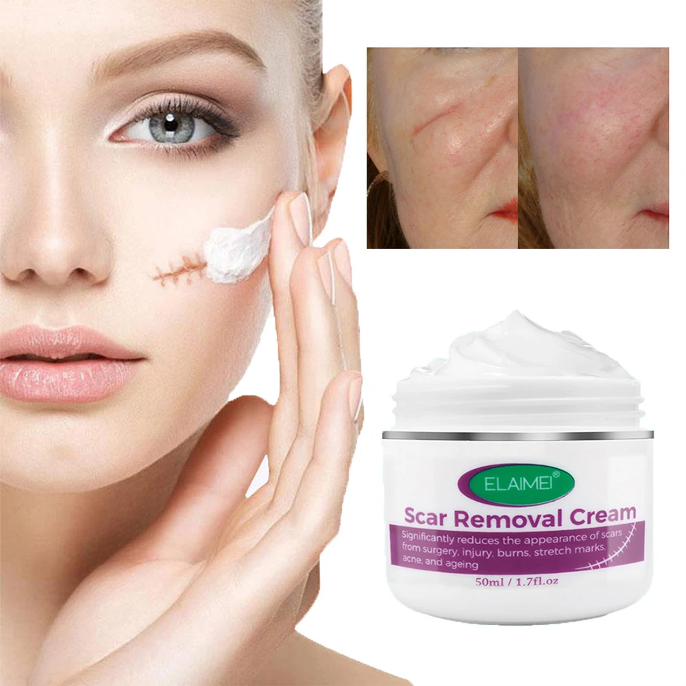 

Scar Removal Cream Scar Cream for Acne Marks, Burns, Stretch Marks, Surgical Scars Promote New Skin Growth Scars Treatment
