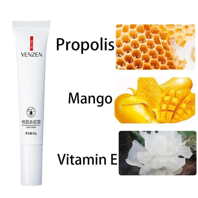 

Acne Treatment Face Cream Anti Acne Oil Control Shrink Pimple Stretch Skin Whitening Pores Cream Care Marks Moisturizer Rem Z5Z1