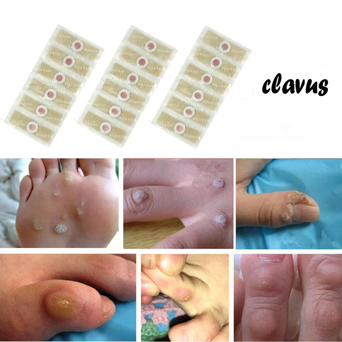 30 шт. Уход за ногами пластырь для удаления мозолей плантационные бородки