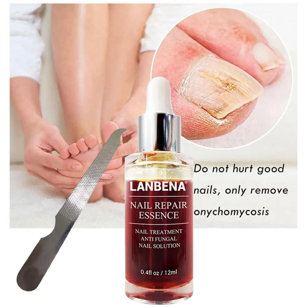 Лечение ногтей от грибка Уход за ногами и ногтями ремонт эссенция