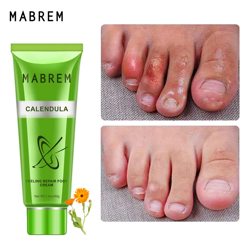 2PCSMABREM стопы лечение крем отбеливающий для лица против трещин увлажняющий ног