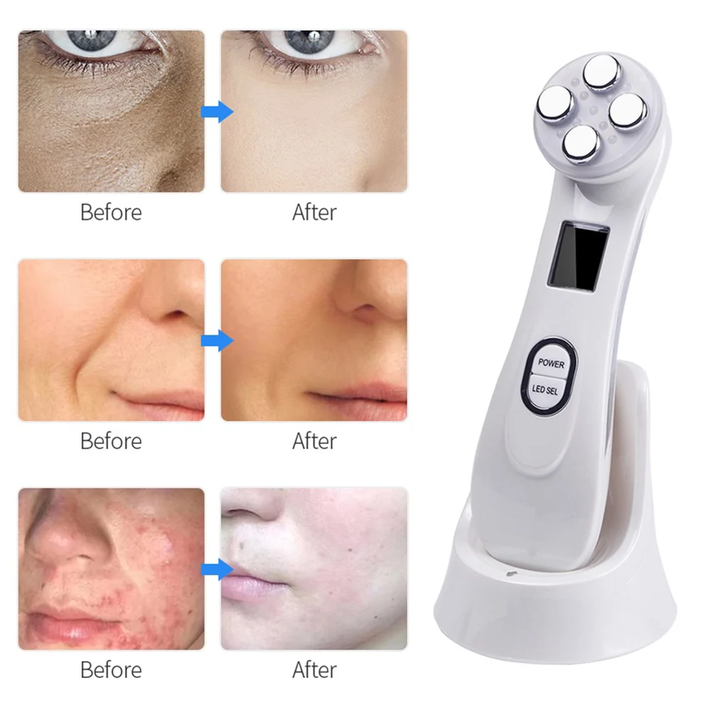 

5 Light Waves Face Lifting Tightening Anti-Wrinkles Face Care Tool Wrinkle Remover Hot Cool Ultrasonic Face Lifting Device