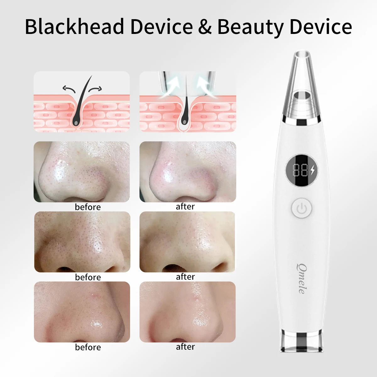 

Qmele Electric Blackhead Remover Vacuum Cleaner Acne Black Point Cleaning Tool Facial Pore Spots Pimple Suction Face Machine