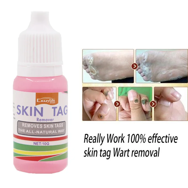 

2 pcs Remove calluses and remove wart liquid removes skin tags skin tags wart removal foot corn remove Natural ingredients