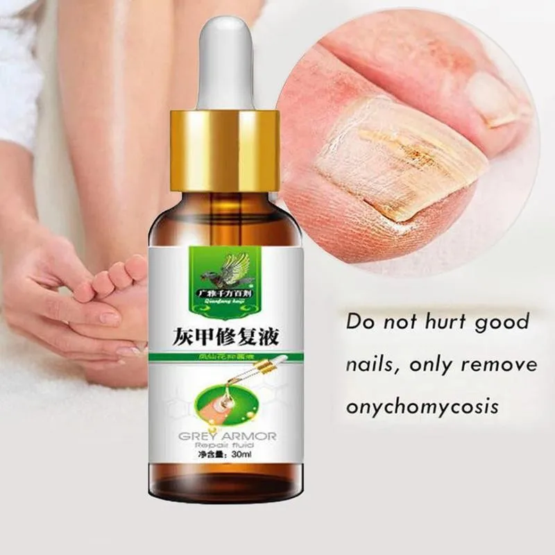 Herbal Fungal Nail Treatment Essential Oil Nail Nail Removal Anti Feet Paronychia Infection Care Fungus Onychomycosis Infec M5K7
