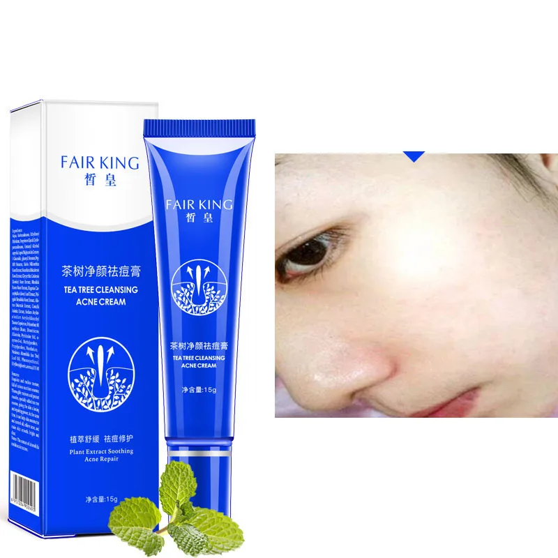 

Средство для удаления черных точек и акне, 15 мл