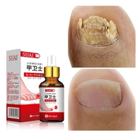 nail fungal treatment essence nail foot whitening toe nail fungus removal gel anti infection paronychia onychomycosis feet care