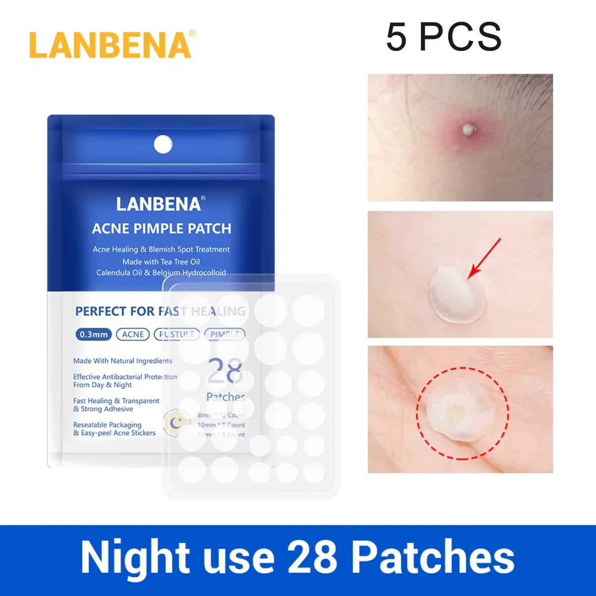 LANBENA акне прыщи патч ночное использование невидимые наклейки Удаление лечение