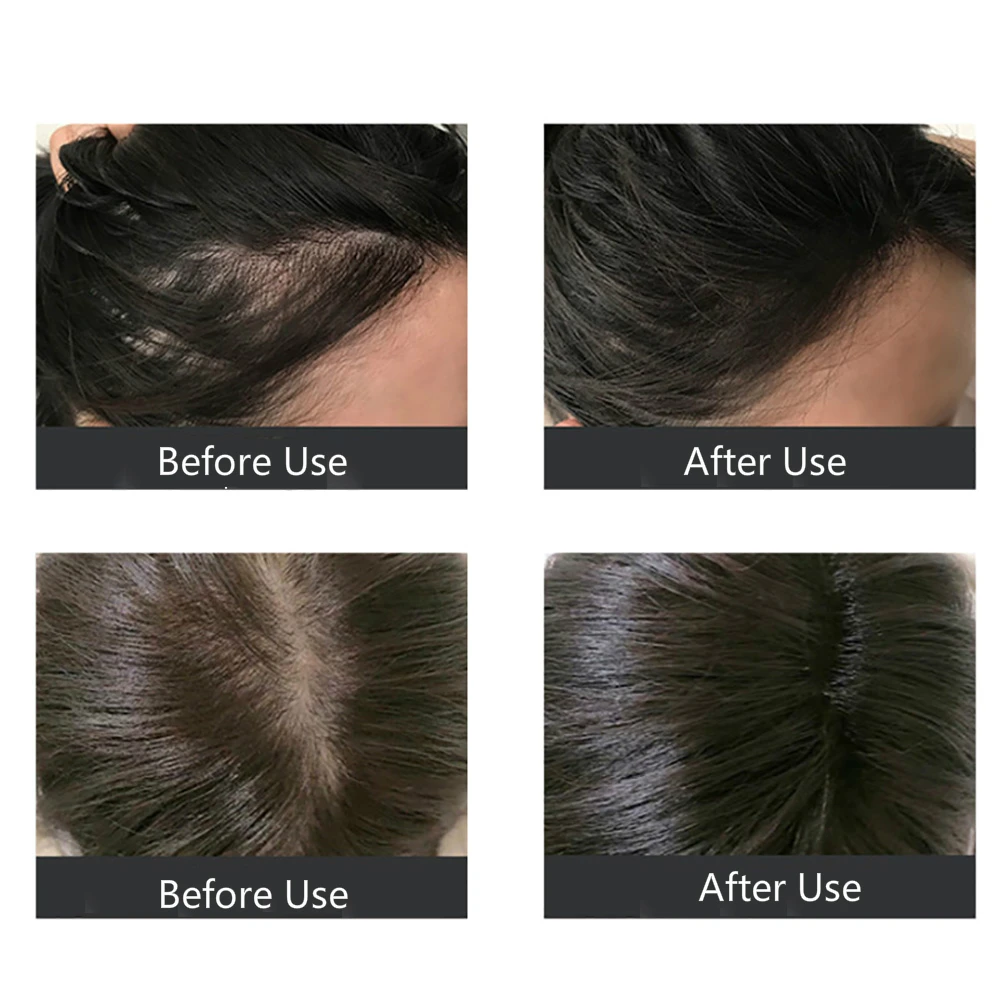 Сыворотка многоцветковая для роста волос 20 мл | Красота и здоровье