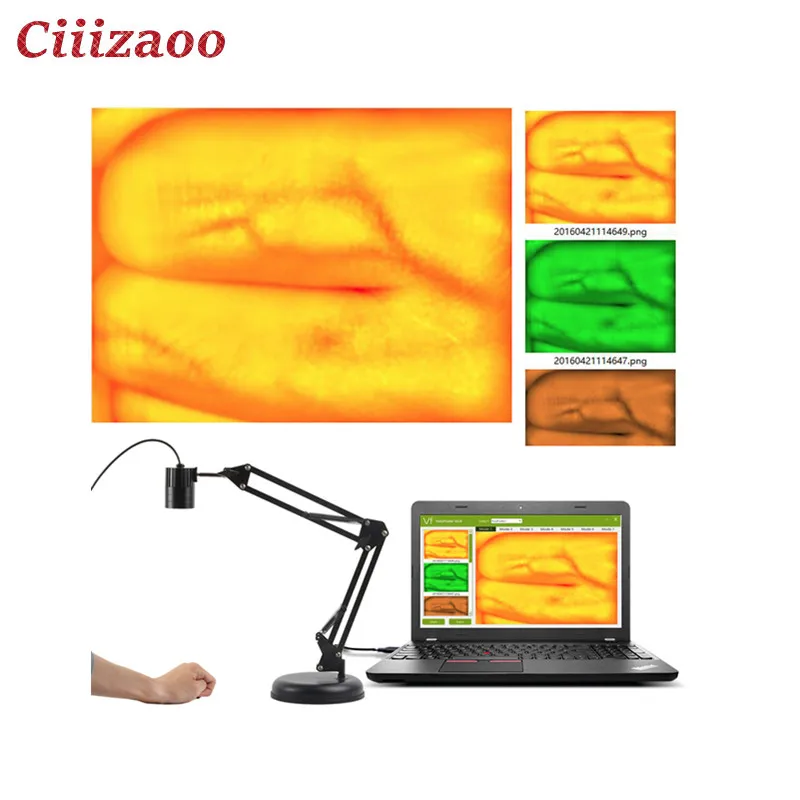 

New medical handheld Portable Hospital Clinic Equipment Infrared vein finder vein viewer