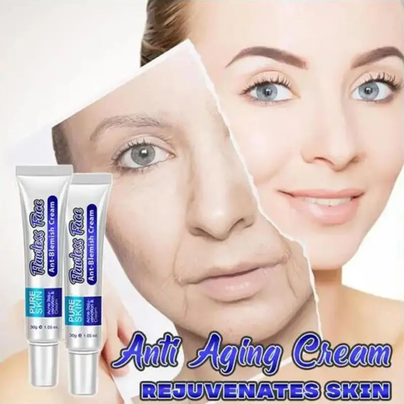 Natural Herbal Topical Cream Face Pimples Scar Stretch Marks Removal Acne Cream Whiten Face Skin Care Treatment