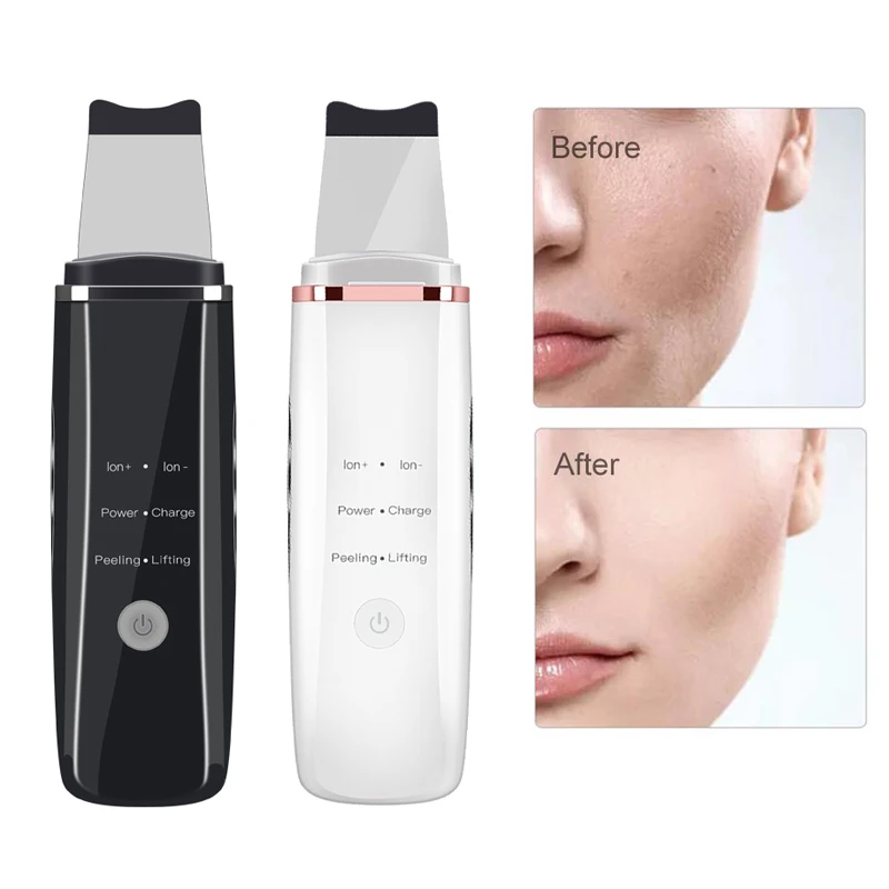 Ультразвуковой Электрический скребок для кожи лица спа прыщей ПОР удаления