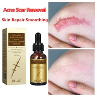 30ml scar repair cream repairing removing burn scars promote cell acne smoothing whitening moisturizing body moisturize body