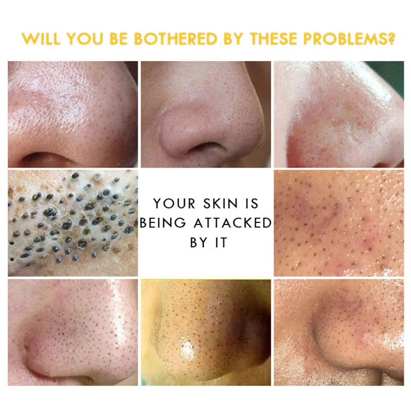 Лучшая увлажняющая маска для лица очищающая от черных точек питательная ухода за