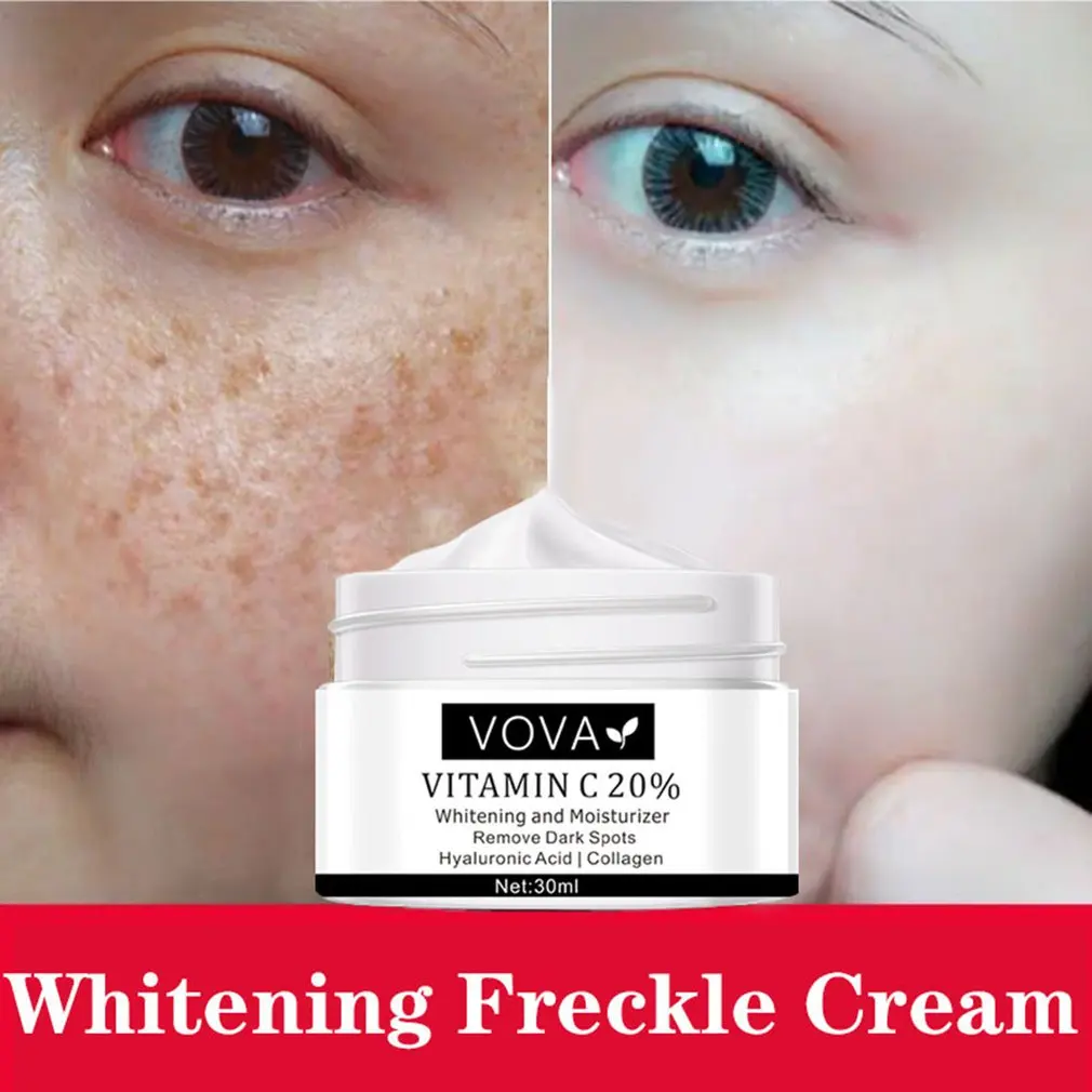 

Face Cream Vitamin C 20% Remove Dark Spots Facial Cream Repair Fade Freckls Melanin Remover Brighten Skin 30ml