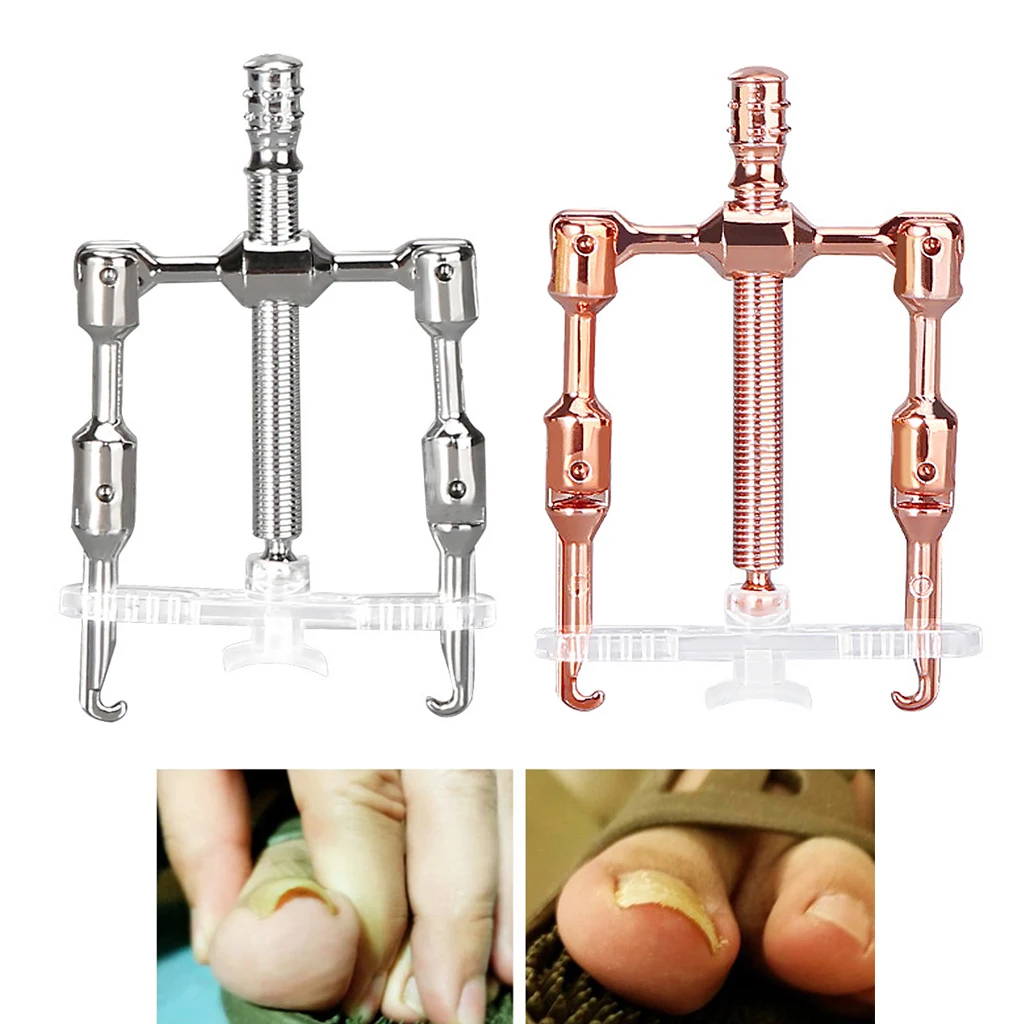 

Stainless Steel Brace Wire Mini Toe Nail Corrector Correction for Pedicure Foot Ingrown Toenail Paronychia