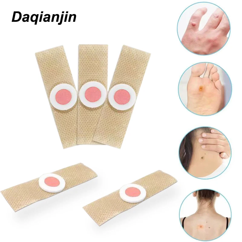 30 шт. пластыри для удаления мозолей и бородавок|Инструмент ухода за ступнями| |