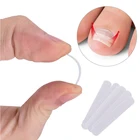 5 комплектов инструментов для коррекции вросших ногтей, эластичная заплатка для пальцев ног, для выпрямления ногтей, педикюра, ортопедических средств по уходу за ногами