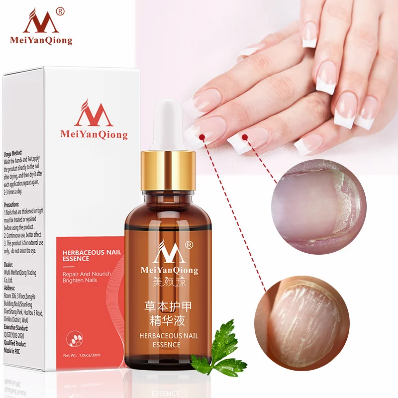 

MeiYanQiong Fungal Nail Treatment Feet Care Essence Nail Fungus Removal Gel Anti Infection Paronychia Onychomycosis Dropshipping