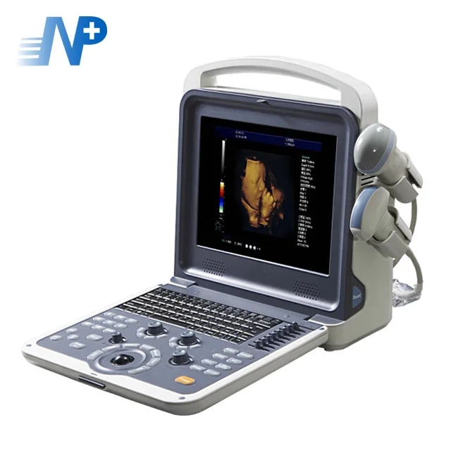 

NPUS069 High Imaging Quality Portable Color Doppler Ultrasound Scanner