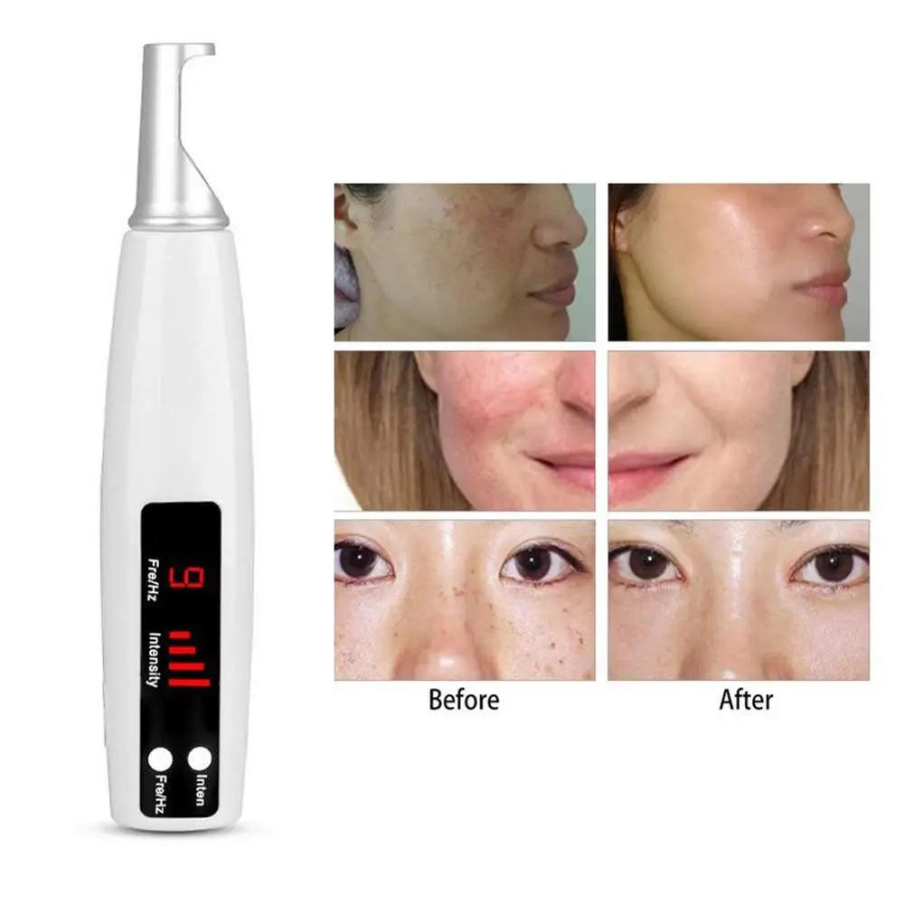 Красный свет пикосекундная лазерная ручка терапия пигмент тату шрам моль