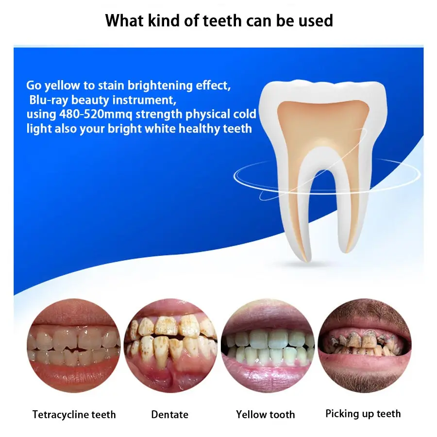 Отбеливание зубов светодиодный светильник Профессиональный ослепительно белых