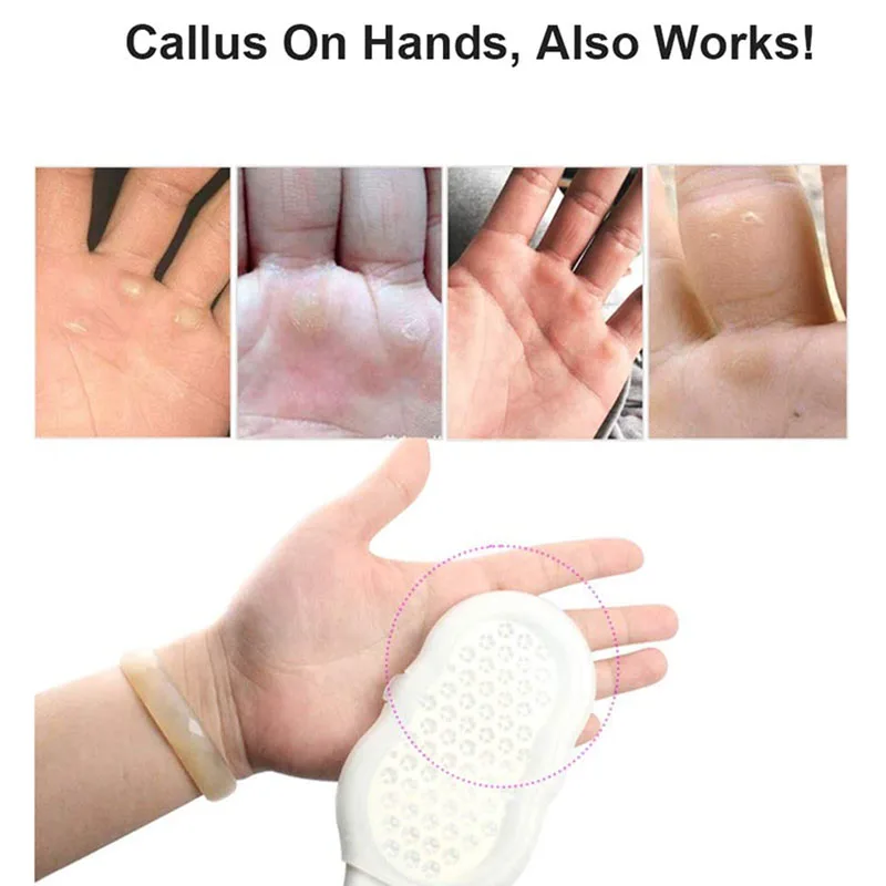 

1 Pcs Stainless Steel Callus Remover Foot File Scraper Pedicure Tools Dead Dead Skin Remover for Feet Foot Care