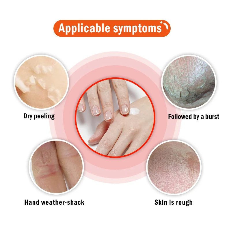 Банановое масло крем для ног 20g устройство удаления омертвевшей кожи анти-сушки