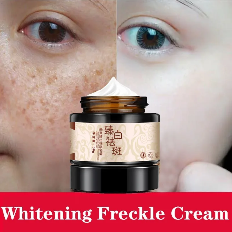 

Powerful Whitening Freckle Cream Chinese Herbal Plant Face Cream Remove Freckles and Dark Spots 30g Skin Whitening Cream