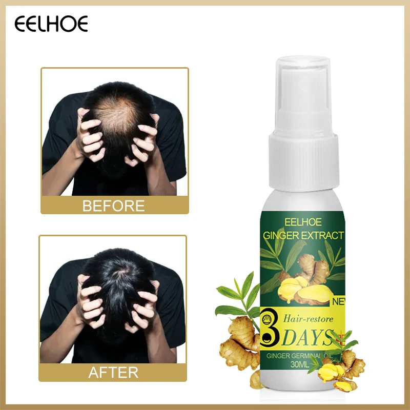 

Сыворотка для роста волос EELHOE, экстракт имбиря для предотвращения выпадения волос, масло для кожи головы, лечение мужских и мужских волос, п...