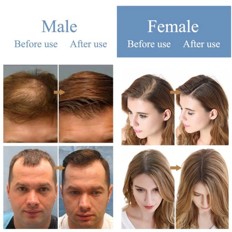 

Fibers Hair Building Pure Natural Botanical Ingredients Easy To Use Hair Density Fiber Powder Hair Styling