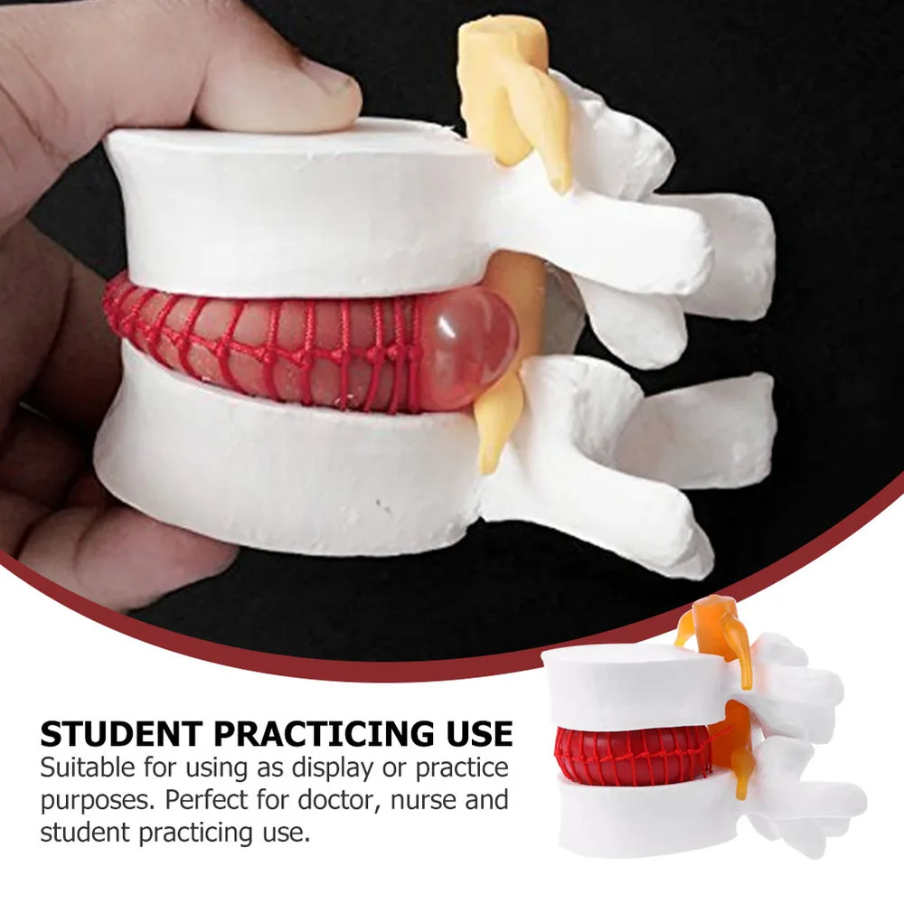 

1pc Human Lumbar Disc Herniation Demonstration Model for Lumbar Spine Teaching