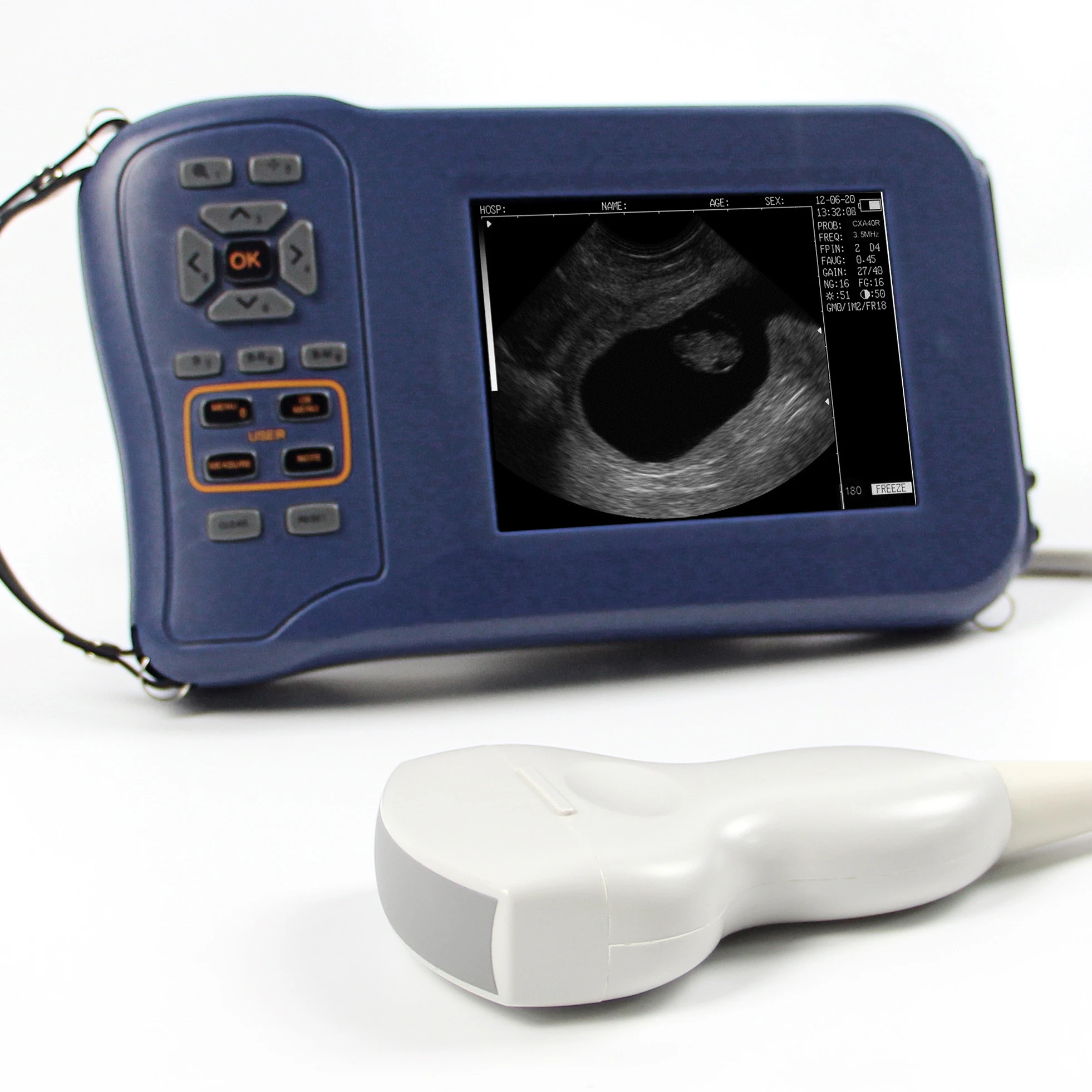 Handheld Ultrasound scanner/ecografo portatil Veterinaria