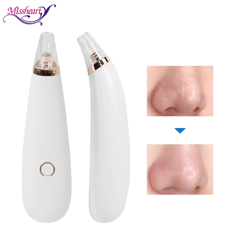 Средство для удаления черных точек MissHeart вакуумный прибор на носу и пор