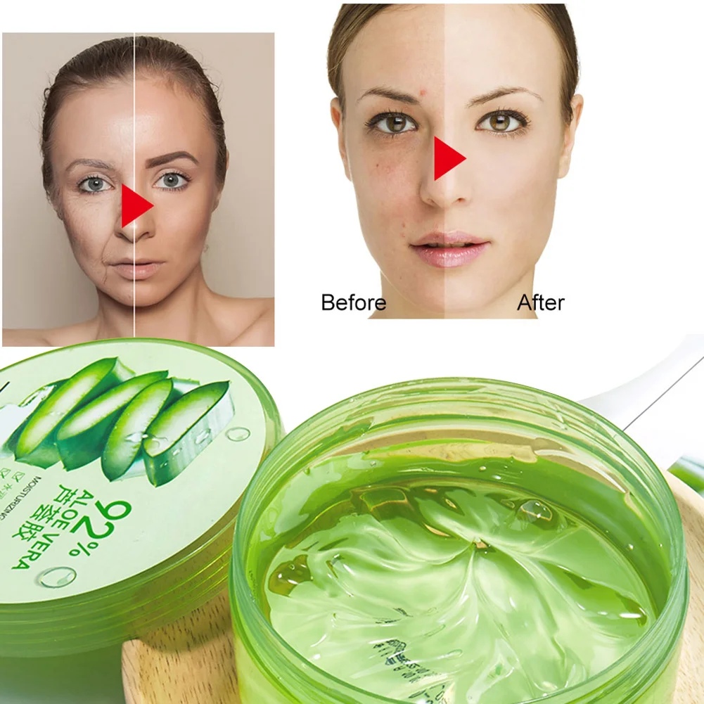 

300g Aloe Face Moisturizing Gel 92%Natural Sunburnt Repairing Face Creams Treatment Gel Acne Soothing Cream Skin Care